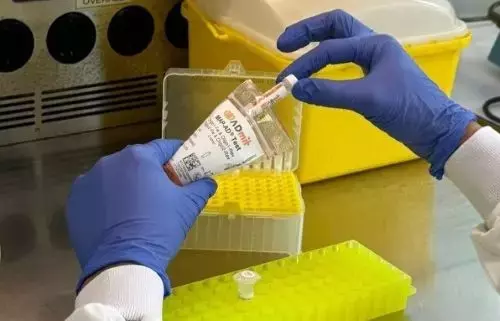 Descubrimiento innovador: un biomarcador para predecir el Alzheimer temprano