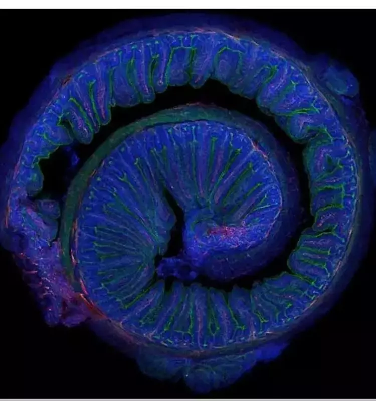 Influencia de la Microbiota Intestinal y el Ejercicio en la Plasticidad Cerebral