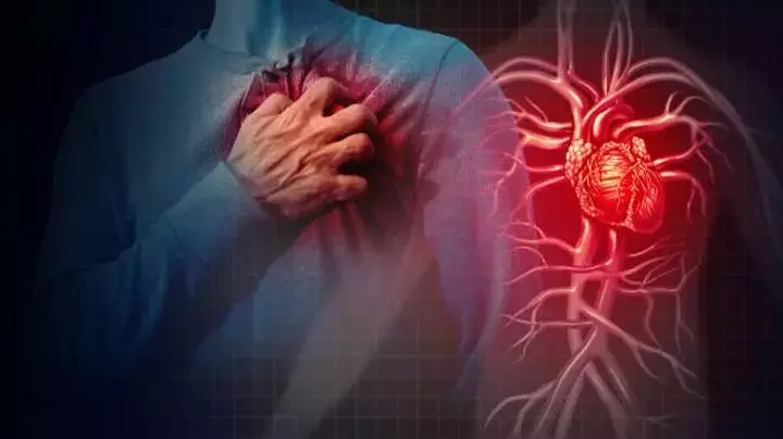 Understanding Heart Disease: A Comprehensive Scientific Overview