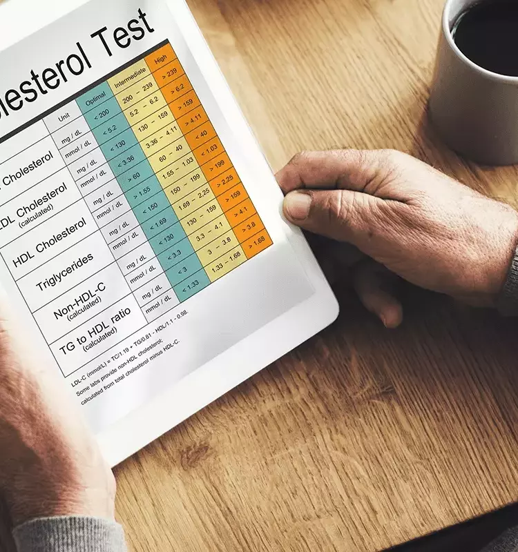 Understanding High Cholesterol: A Scientific and Technical Overview