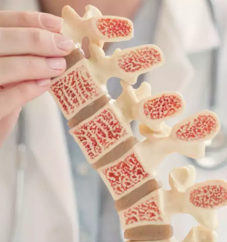 Understanding Osteoporosis: A Scientific and Technical Overview