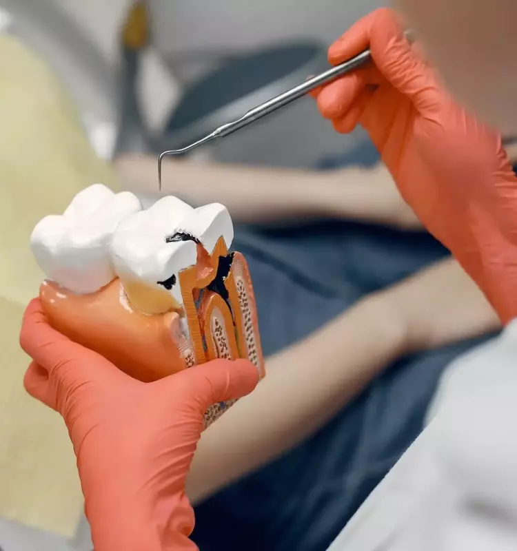 Root Canal Treatment: Understanding Dental Procedures for Tooth Preservation
