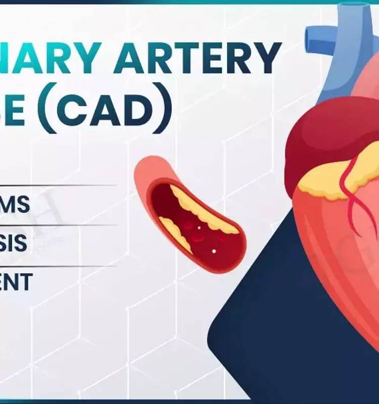 Coronary Artery Disease: A Technical and Clinical Overview