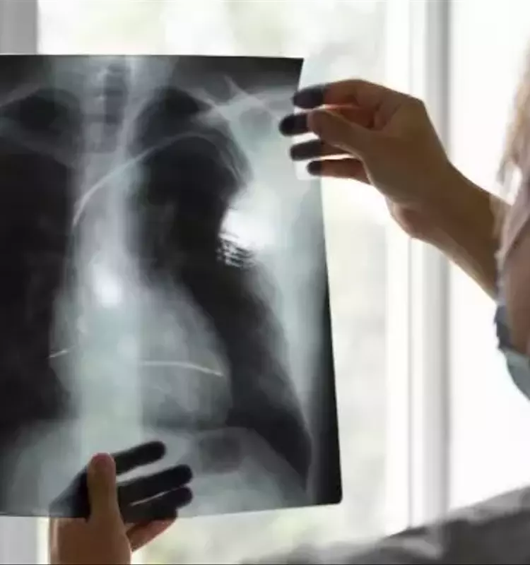 Pneumonia: A Comprehensive Technical and Biological Overview