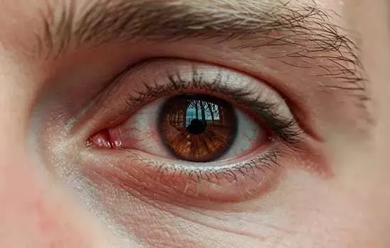Ojo Seco: Una Afección Grave que Demanda Atención Urgente