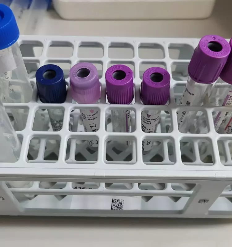 Tests Genéticos para Adelgazar: ¿Motivación o Genética?
