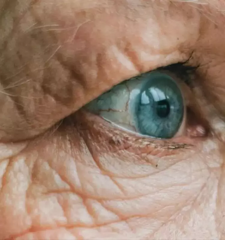 Descubrimientos Novedosos sobre la Retina como Marcador Temprano del Alzheimer