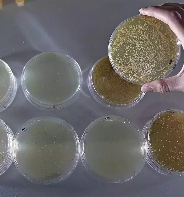 La Importancia Fundamental de una Microbiota Intestinal Equilibrada para la Salud General