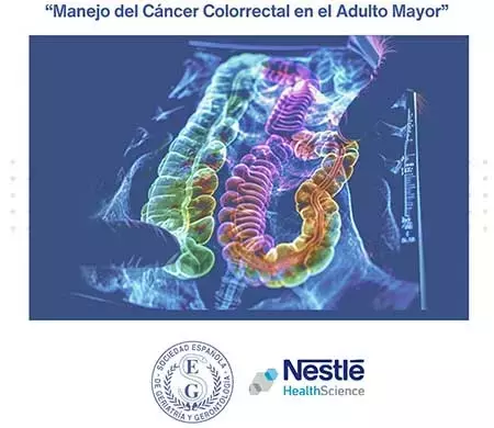 SEGG lanza programa educativo avanzado sobre el cáncer colorrectal en adultos mayores