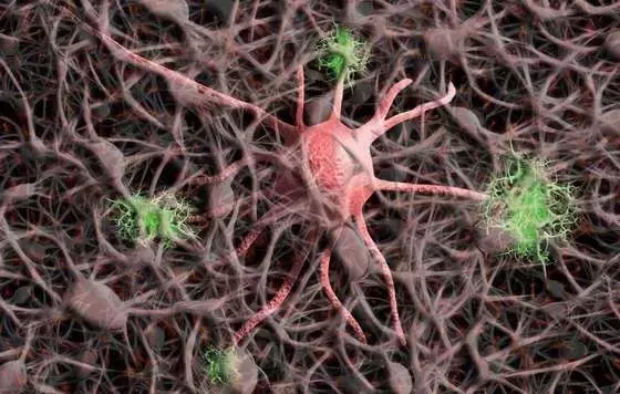 Descubrimiento de la Proteína PRKCG: Un Avance Prometedor Contra el Alzheimer