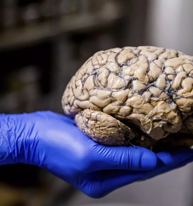 Descubrimientos en el Líquido Cefalorraquídeo Abren Nuevas Vías Contra Tumores Cerebrales