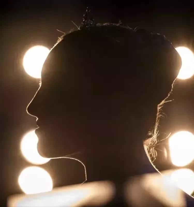 La migraña hormonal en mujeres: un problema infradiagnosticado y subtratado