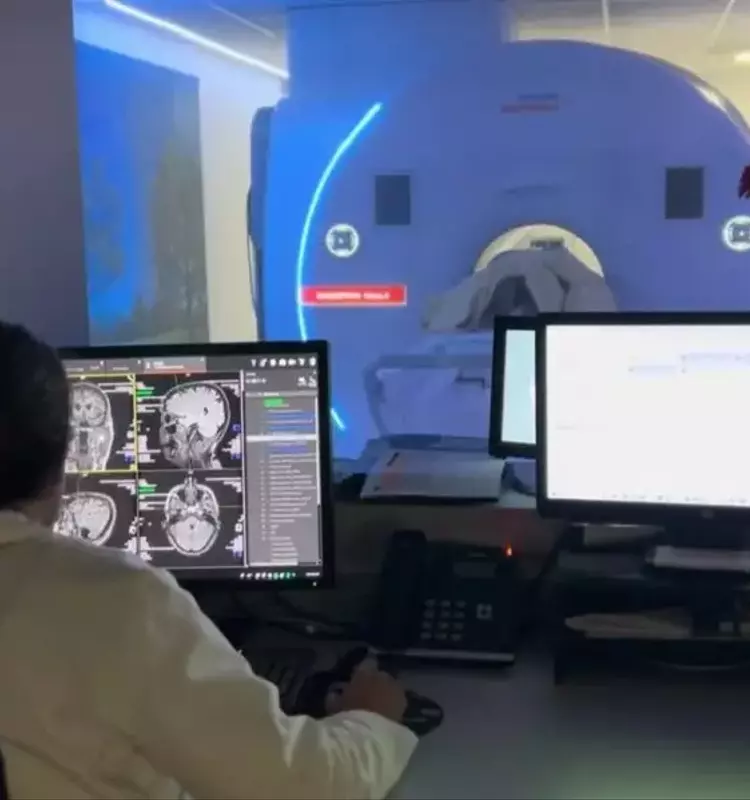 La Falta de Recuerdo de Sueños: Una Posible Alerta Temprana de Alzheimer