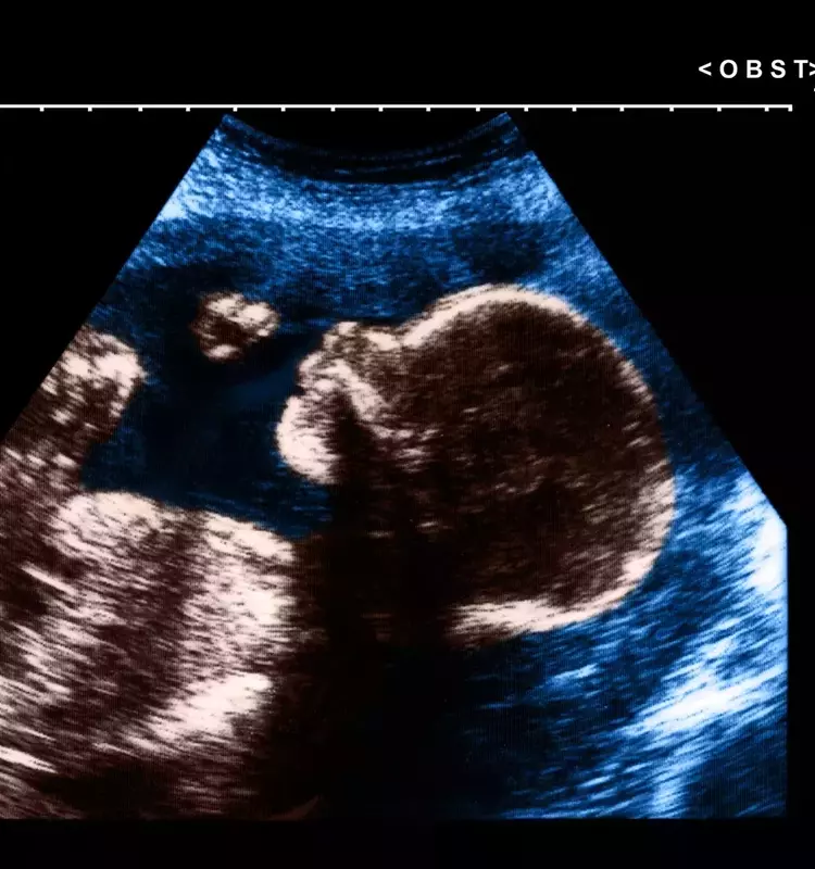 The Art and Impact of Pregnancy Nicknames