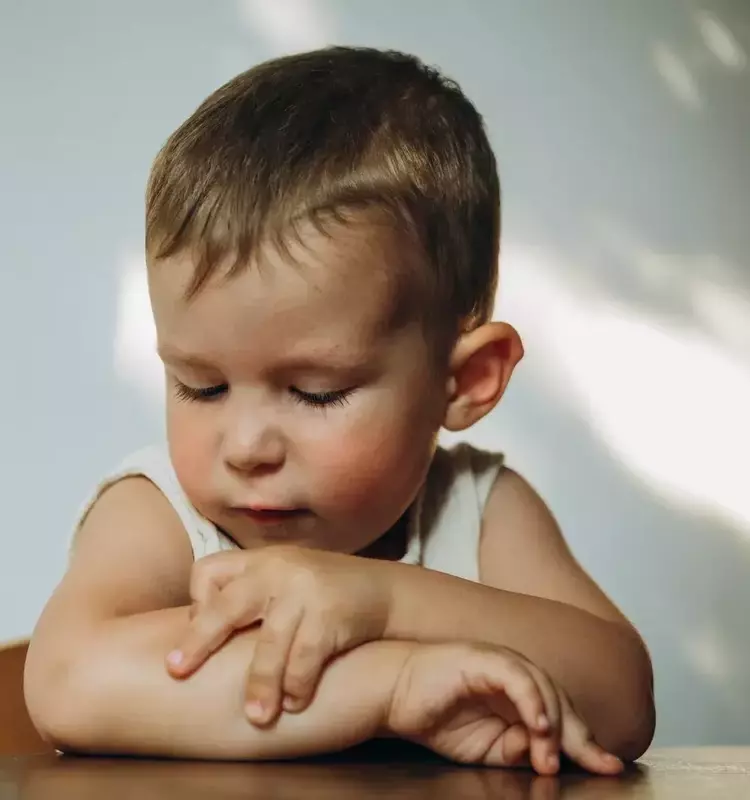 Understanding and Managing Eczema in Children
