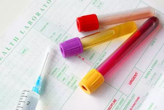 Guardant Health: The Next Phase of Growth Driven by Advanced Diagnostics