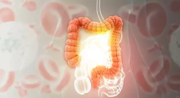 Palisade Bio: Pioneering Ulcerative Colitis and Crohn's Treatment
