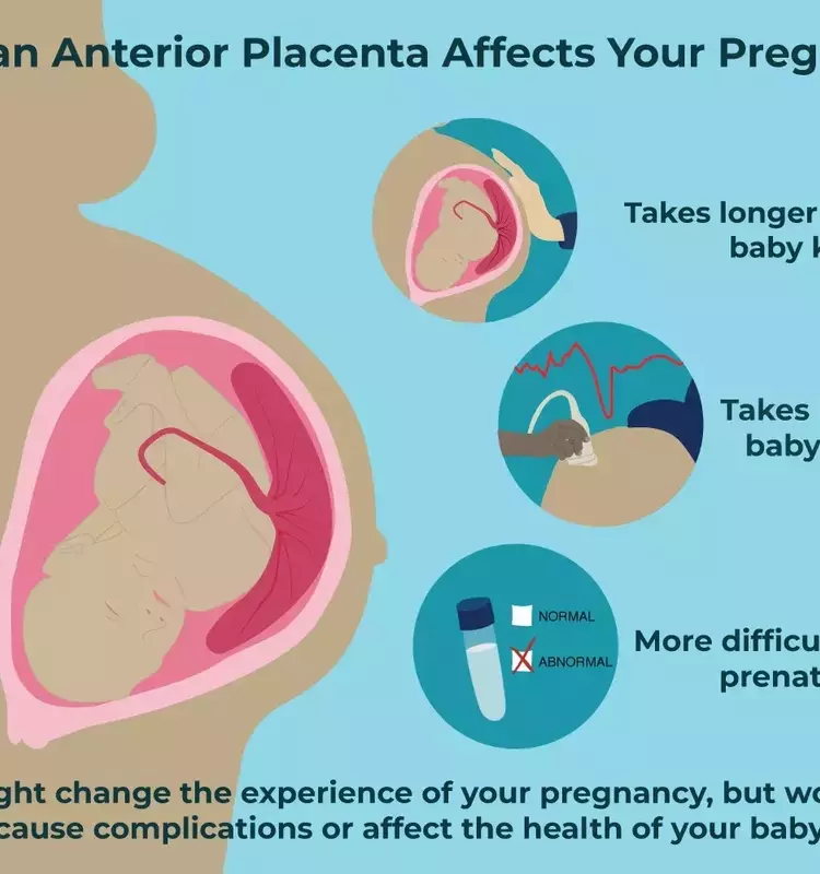 Understanding Anterior Placenta During Pregnancy