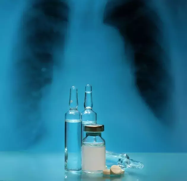 Connect Biopharma: Rademikibart & The Dupixent Challenge in Asthma/COPD